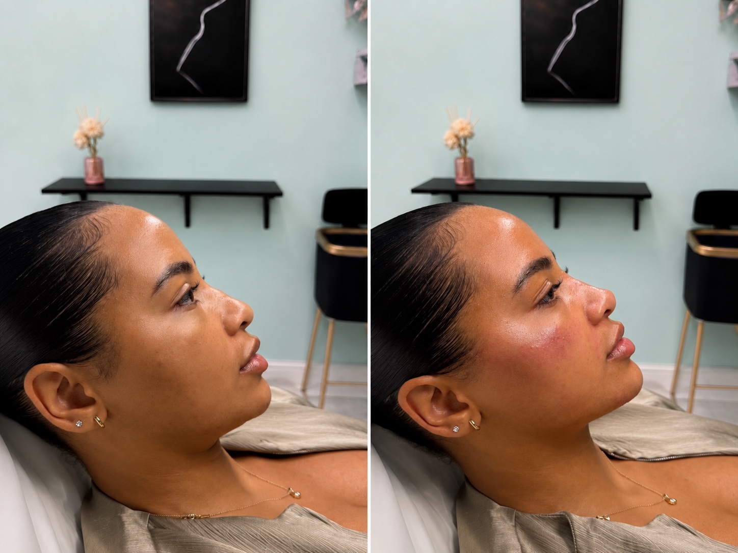 RichYourMink client shown before and after her aesthetic treatment